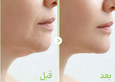لیفت و سفتکنندگی فوری غبغب: کمک به جمع شدن پوست ناحیه چانه و غبغب با اثر فشاری ملایم. ضدپف و کاهش تورم (De-Puffing): برطرفکننده احتباس آب زیر فک و کاهش ورم صورت به کمک کمپلکس Aquaslim EX. اثر خنککنندگی و تسکیندهنده: خنک کردن فوری بافت پوست برای سفتسازی منافذ و ایجاد حس شادابی. فرمدهی ناحیه V-Line: بهبود خط زاویه فک و تعریف بهتر مرز چانه و گردن. بافت هیدروژلی چسبان: انتقال بهینه مواد موثره به بافت زیرین بدون سر خوردن ماسک. طراحی ارگونومیک با آویز گوش: دارای برشهای استاندارد برای قرارگیری آسان و راحت روی گوش بدون درد.